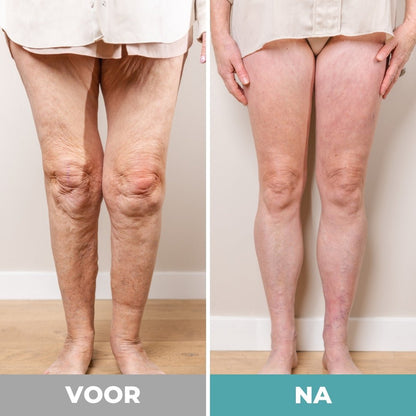 NeuroFlow™ | Loop weer zonder pijn, tintelingen of zware benen, Herstel je doorbloeding in 15 minuten per dag