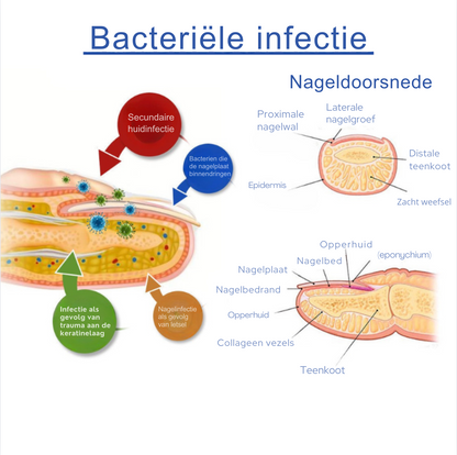 Clearnail™ | Durf Je Nagels Weer te Laten Zien, oplossing tegen Schimmelnagels!