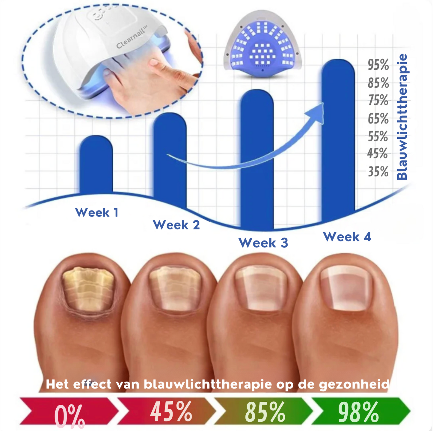 Clearnail™ | Durf Je Nagels Weer te Laten Zien, oplossing tegen Schimmelnagels!