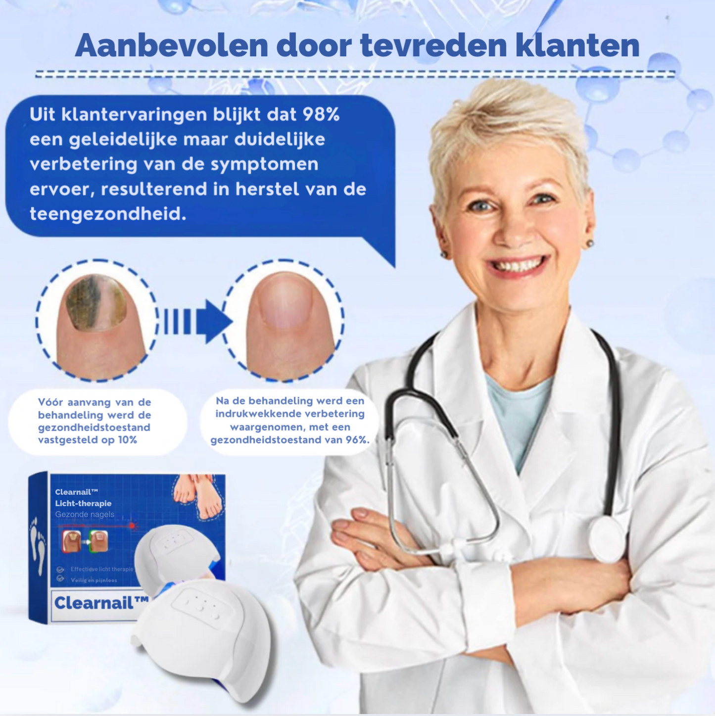 Clearnail™ | Durf Je Nagels Weer te Laten Zien, oplossing tegen Schimmelnagels!