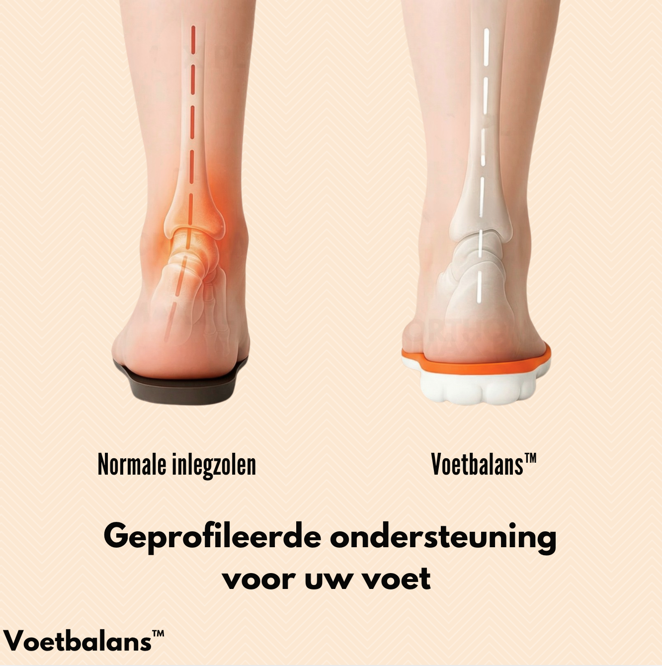 Voetbalans™ | Zeg Vaarwel Tegen Voetpijn – Orthopedische Inlegzolen voor Pijnvrij Lopen. 1+1 GRATIS